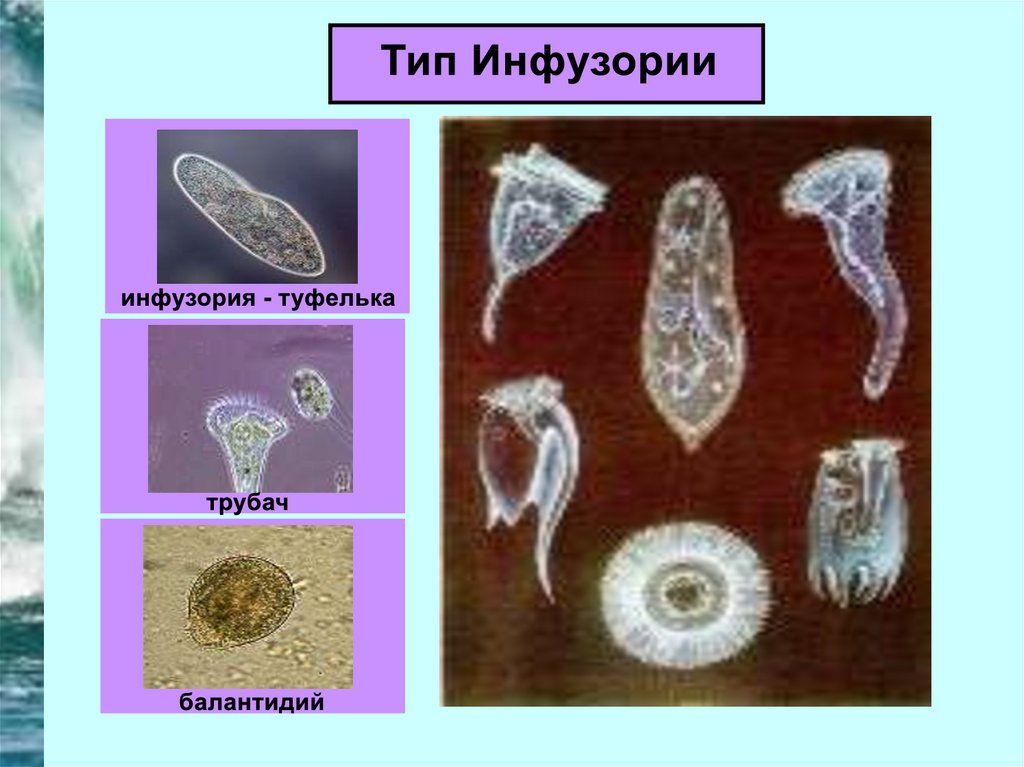 Виды инфузорий картинки