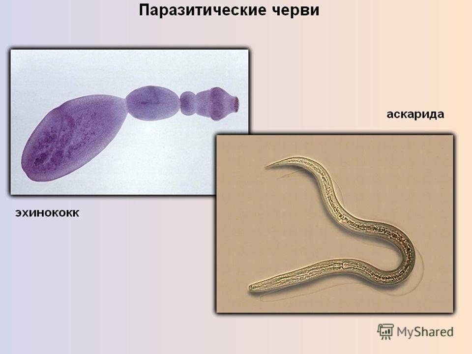 Паразитический червь пищеварительная система. Простейшие паразиты. Желудочно кишечные глистные заболевания. Паразитические черви не имеют пищеварительной системы.