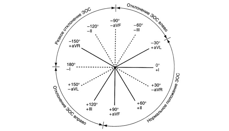 Ось определение. Электрическая ось сердца на ЭКГ. Как считать электрическую ось сердца. Определить электрическую ось сердца по ЭКГ. Электрическая ось сердца на ЭКГ таблица.