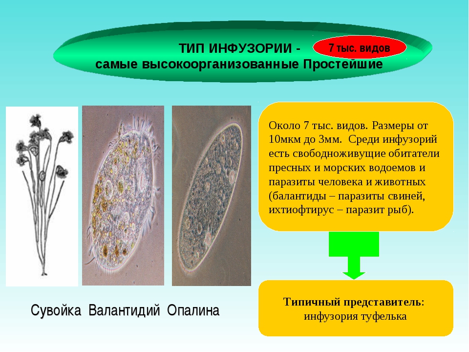 Цитостом. Класс Ресничные инфузории представители. Тип инфузории Ресничные. Тип простейшие инфузории многообразие. Представители Тип инфузории класс Ресничные.