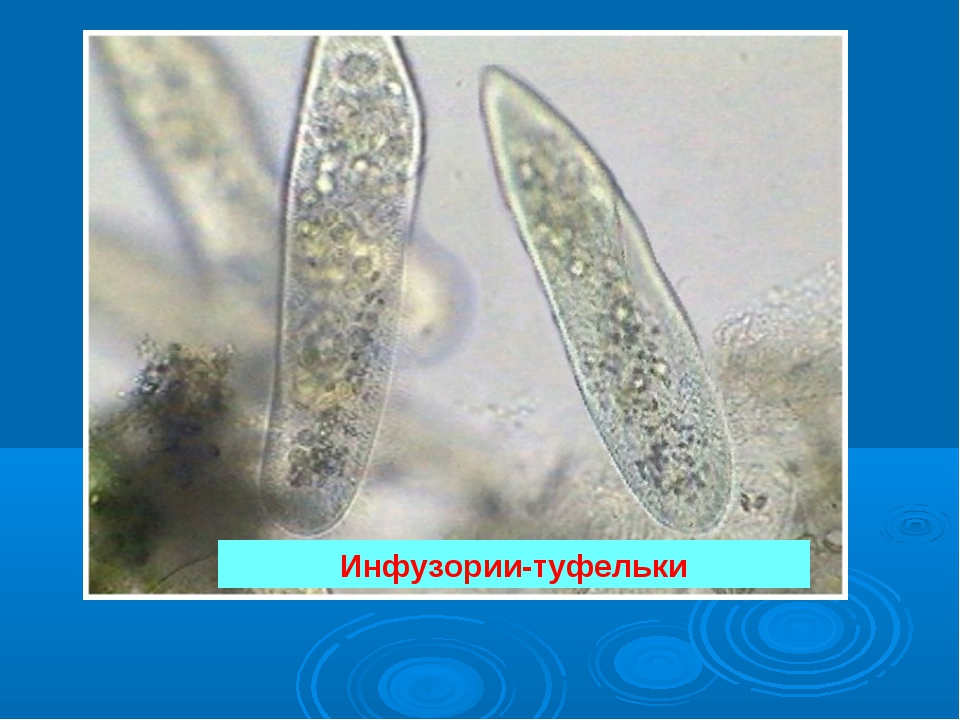 Инфузория туфелька среда обитания. Инфузория туфелька под микроскопом 5 класс. Инфузория туфелька микробиология. Инфузория-туфелька это бактерия.