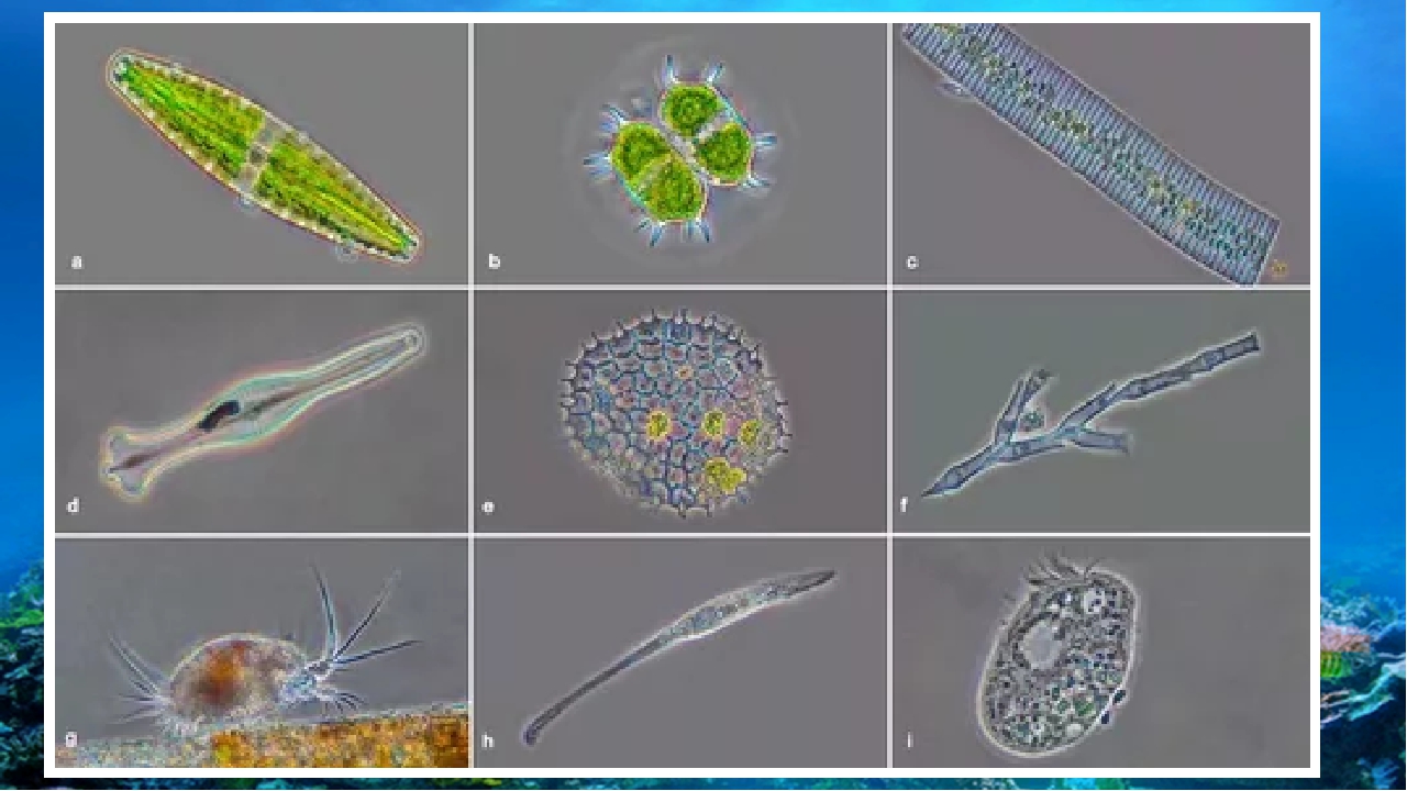 Простейшие организмы в воде. Эукариотические одноклеточные микроорганизмы. Фитопланктон диатомовые водоросли. Диатомовые одноклеточные водоросли. Инфузория Litonotus.