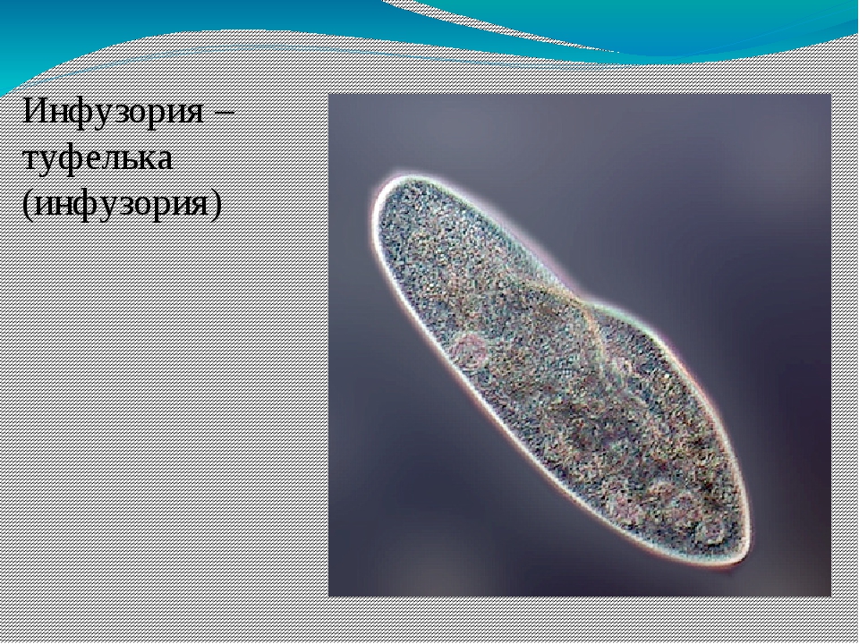 Инфузория туфелька фото строение
