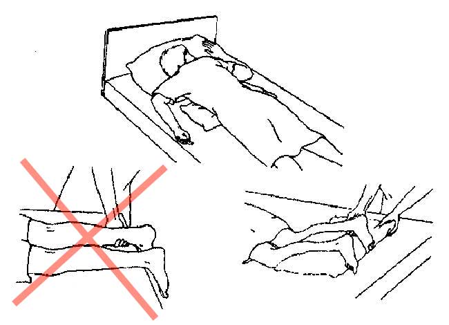 Пользование функциональной кроватью и другими приспособлениями