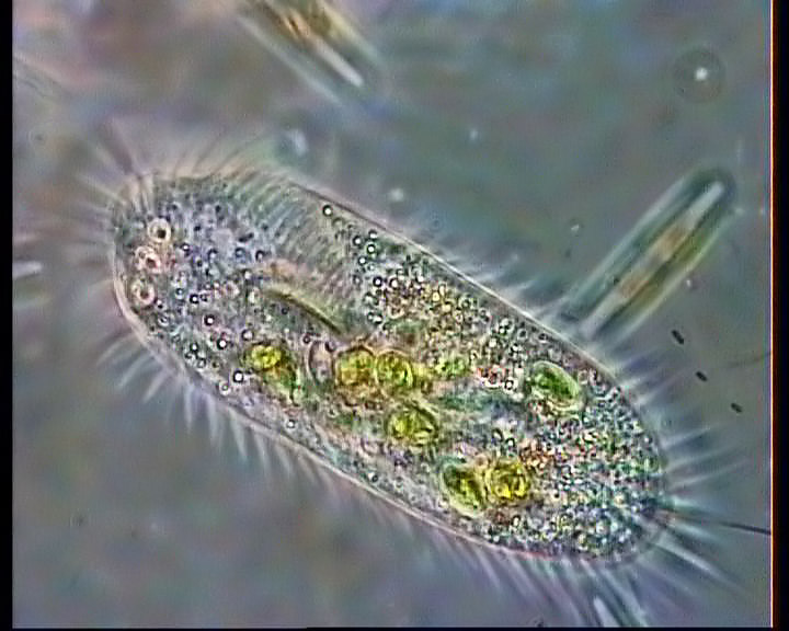 Инфузория туфелька фото. Инфузория стилонихия. Stylonychia pustulata. Инфузория туфелька микрофотография. Инфузория туфелька в микроскопе.