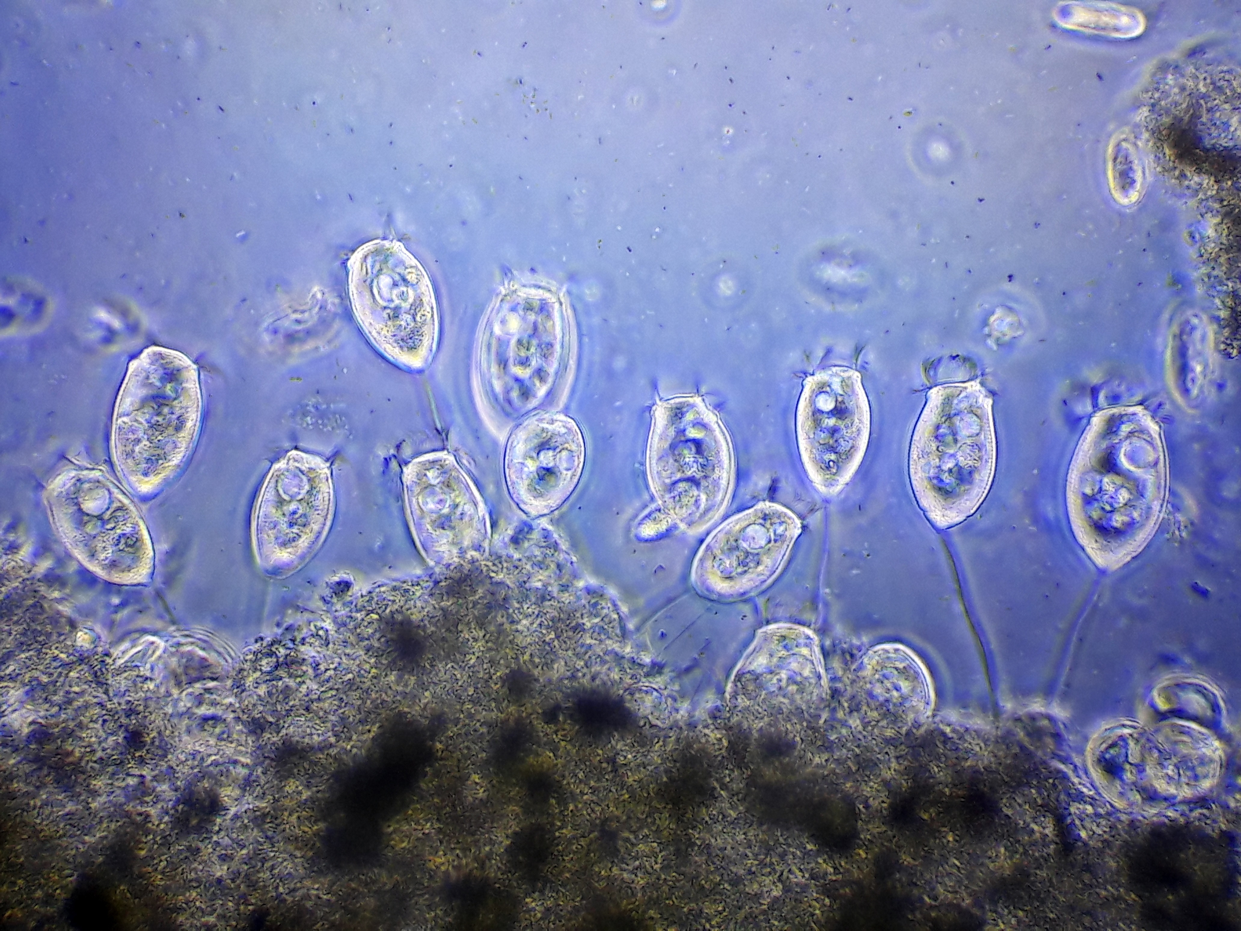 Простейшие организмы в воде. Инфузория Vorticella. Кархезиум инфузория. Клетка инфузории сувойки. Vorticella microstoma.