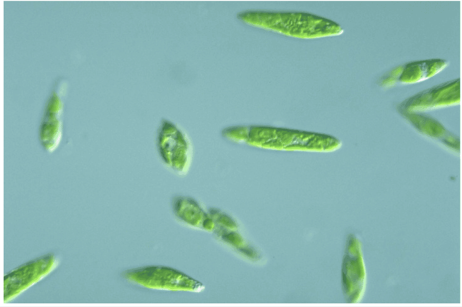 Evglena Zelenaya V Mikroskope Evglena Foto Pod Mikroskopom Internet Magazin Mebeli Mebpilot Ru Shirokij Vybor Nizkie Ceny